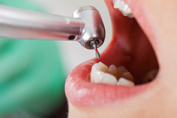 Best Emergency Dental Extractions in East Brewton, AL